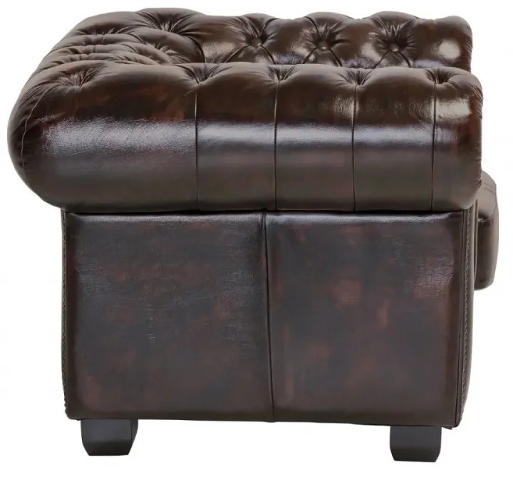furniture-nabytek.cz - Křeslo Chesterfield pravá kůže hnědé