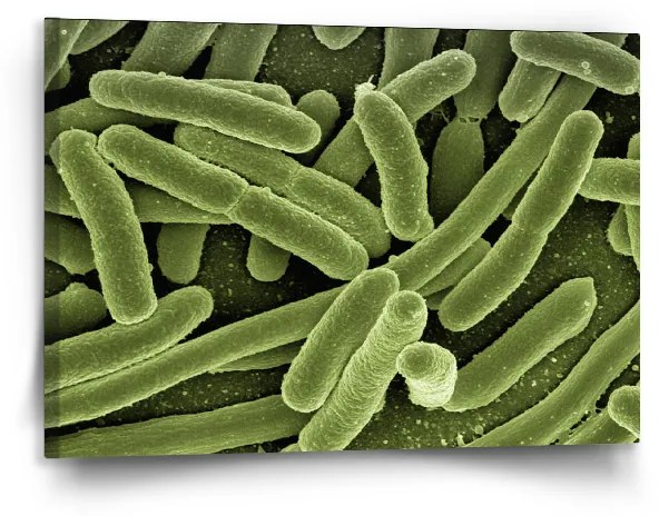 Sablio Obraz Baktérie - 120x80 cm