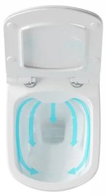 Ravak X01671 - Závesné WC Rimless CLASSIC keramika/biela