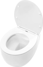 Závesná WC misa so SoftClose sedadlom REA LARS, biela