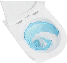 Mexen Rico, závesná WC misa 490x360x370 mm, Rimless Tornádo + WC sedadlo z duroplastu, biela lesklá, 30720300T