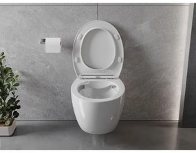 Mexen Egg, závesná WC misa Rimless s duroplastovým sedátkom s pomalým zatváraním, biela lesklá, 30245000