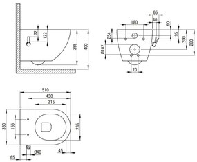 Deante Peonia, závesná WC misa s funkciou bidetu 515x370 mm, čierna matná, DEA-CBP_NWPW