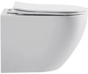 Cerano Cesso, závesná WC misa Rimless, Vortex + UF sedátko - biela matná - 49x36 cm, CER-CER-476681