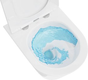 Mexen Rico, závesná WC misa 490x360x370 mm, Rimless Tornádo + WC sedadlo z duroplastu, biela lesklá, 30720100T
