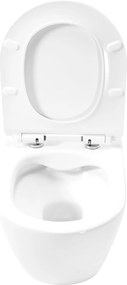 Závesná WC misa so SoftClose sedadlom REA CARTER RIMLESS, biela