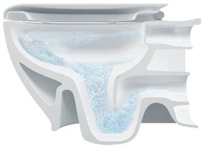 Bruckner - Závesné WC Rimless WALTER keramika/biela