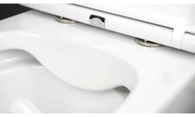 Deante CGRD6ZPW - Závesné WC s sedátkom SoftClose ROUND keramika/biela