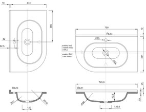 Sapho - Rohové zapustené umývadlo PULSE 75x43 cm mramor/biela